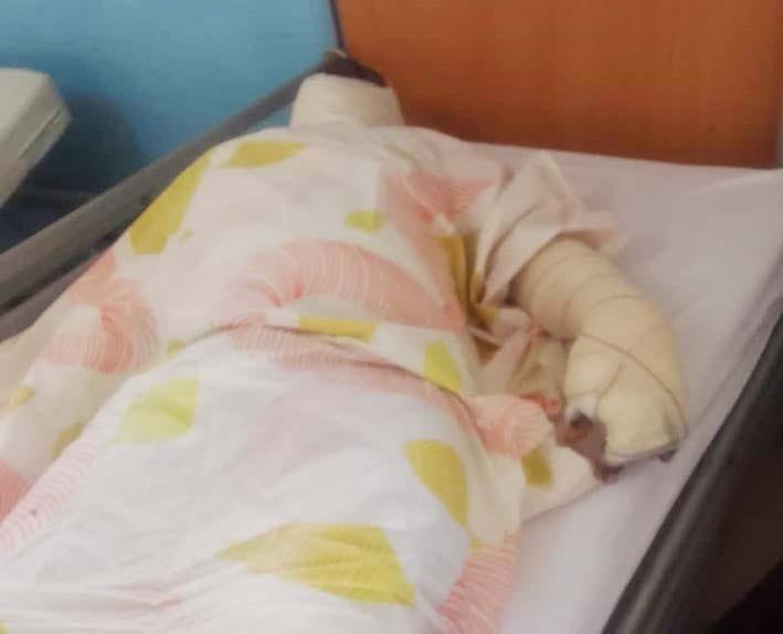 Brûlés du 1er janvier à Yopougon: Malgré le soutien de Bictogo, le père de famille est décédé, Ouattara appelé au secours pour ses enfants