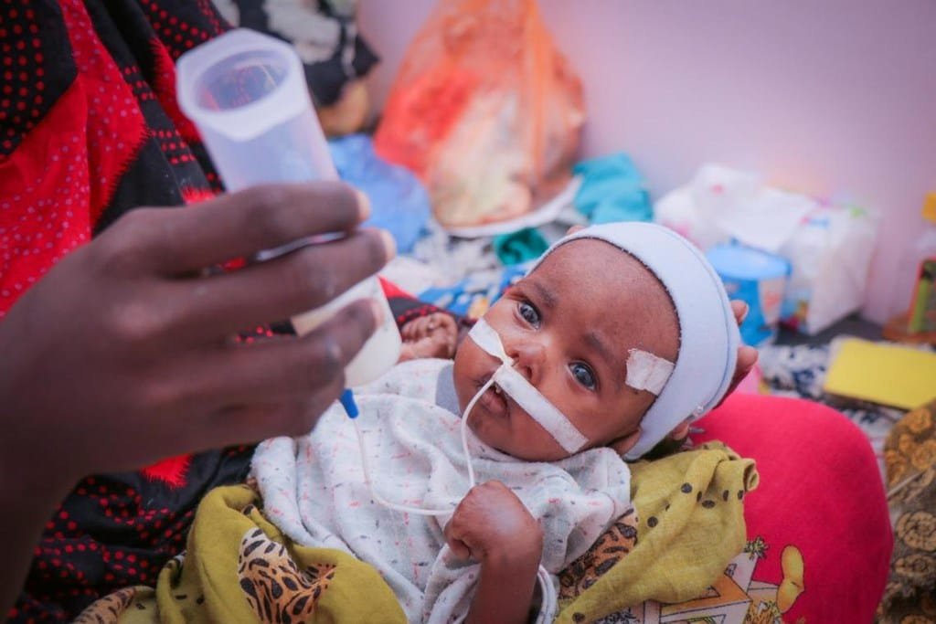 Face à la malnutrition aiguë qui menace la vie de millions d’enfants vulnérables, l’ONU juge urgent d’agir