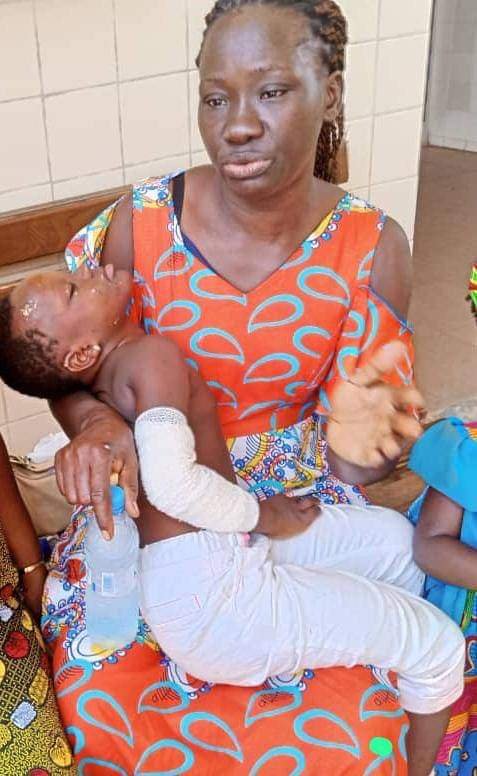 Brûlés de Yopougon : Après 7 mois de traitement, la clinique réclame 90 millions